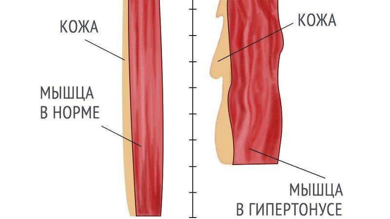 «Ты почему такая злая\грустная?», «Выглядишь уставшей», «А мы думали, ты стерва…».-3