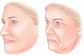 Деформационный тип старения лица: главные признаки. Что делать и чего НЕ делать — объясняет нейрокосметолог